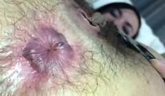 Risika Farting Thong and Hairy Asshole